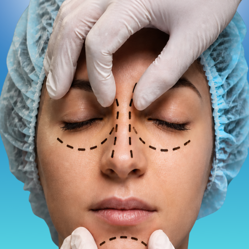 Cosmetic Rhinoplasty