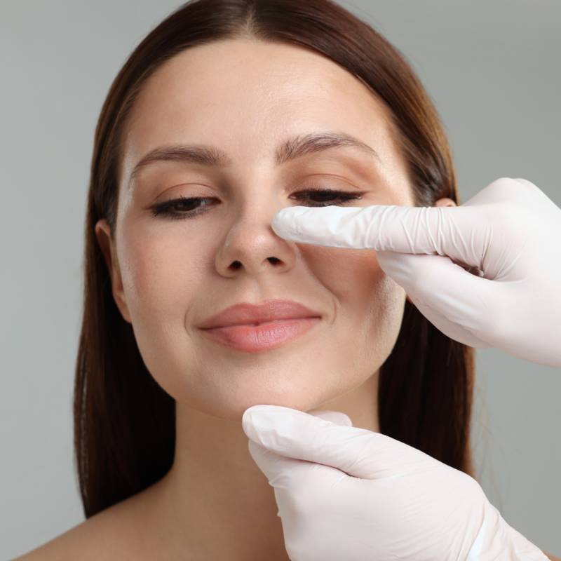Revision Rhinoplasty